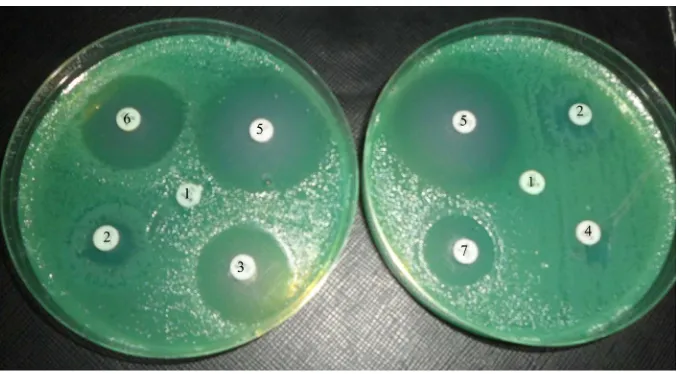 Figure 1. Antibiotic resistance pattern in P. aeruginosa disc 1 of both plates represents for Am-plicillin that showed maximum resistance (100%) followed by discs 2 and 4 of second plate represent for Tetracycline and Gentamycin showed resistance almost si