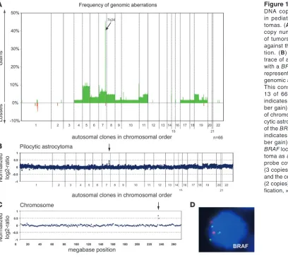 Figure 1DNA copy-number aberrations in pediatric low-grade astrocy-tomas. (A) Frequencies of DNA copy number gains and losses of tumors (n = 66) were plotted against their chromosomal posi-tion
