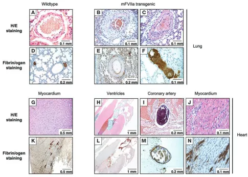 Figure 5Histological findings in lungs and hearts of high-mFVIIa transgenic mice compared with WT littermates