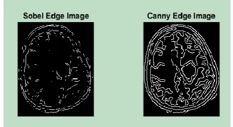 Figure 5 (i) defines that the dilate image calculated with the morphological operators