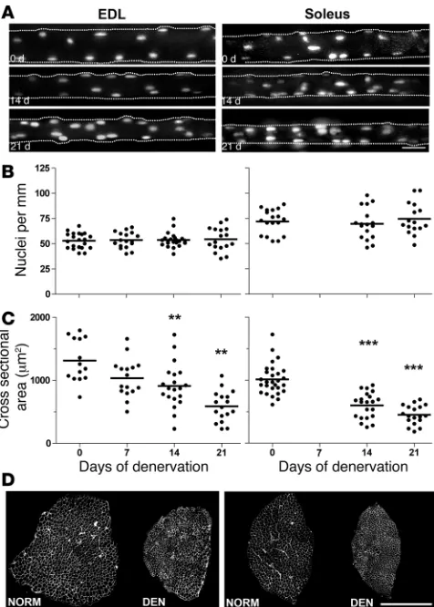 Figure 2The effect of denervation on nuclei number and atrophy of single mus-