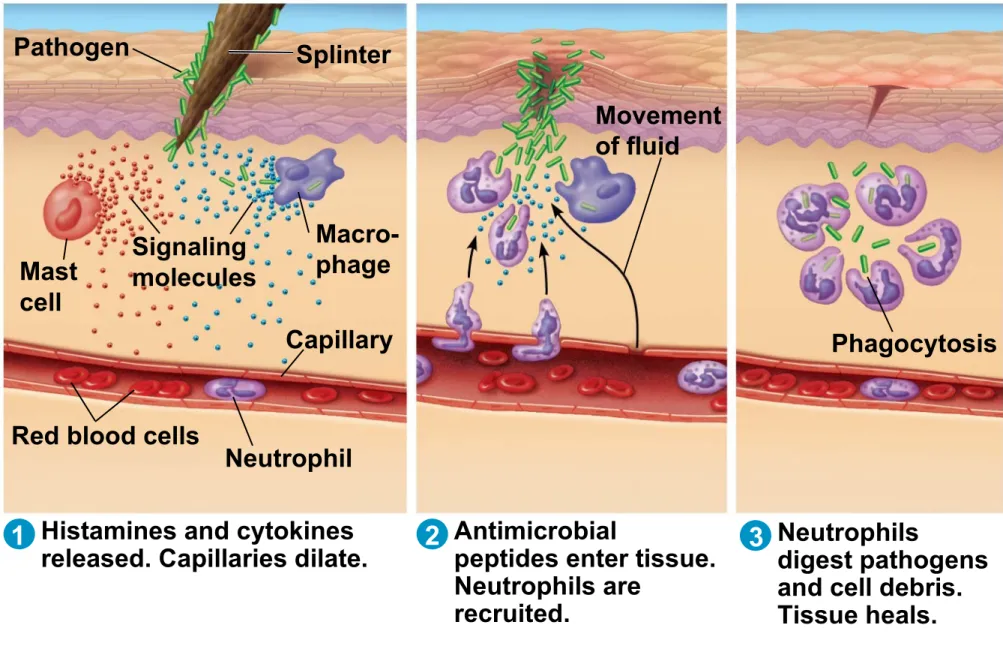 Figure 35.5-3 Pathogen Splinter  Macro-phage Capillary NeutrophilRed blood cells