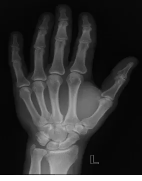 Fig 3 An image of X-rays  