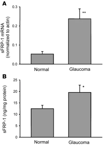 Figure 2Confirmation of sFRP-1 differential expression in glaucomatous TM 