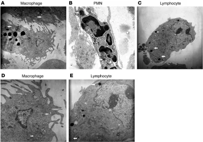 Figure 5Electron micrographs showing END immunoreactivity in inflamed paw tissue. (