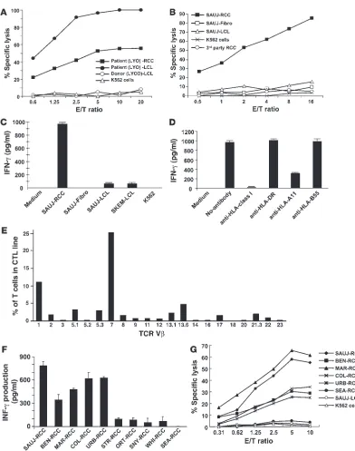 Figure 3Characterization and generation of tumor-reactive CTLs. CTLs and T cell clones that killed patient RCC cells were isolated using PBMCs 