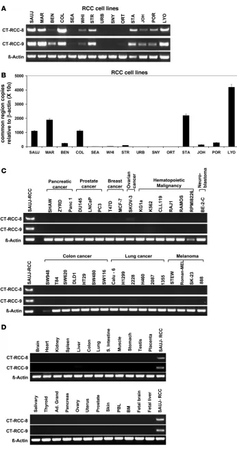 Figure 7Expression of CT-RCC-8 and CT-