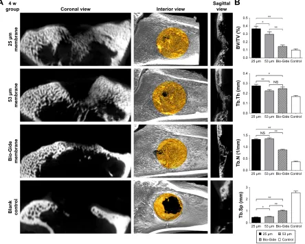 Figure 2 Micro-cT scanning images and analysis results at the end of 4 weeks.Notes: (A) Bone defect models with or without membranes were scanned by micro-cT at 4 weeks postimplantation
