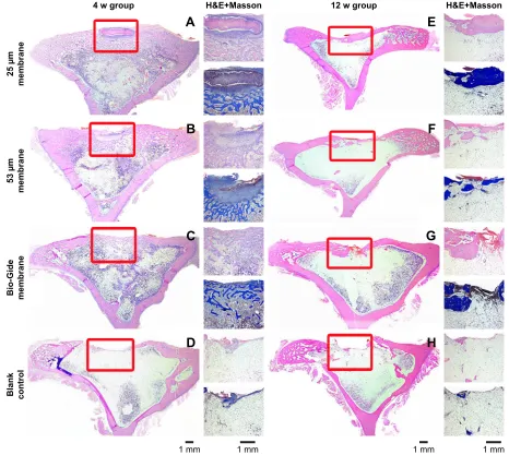 Figure 4 histological analysis results at the end of 4 and 12 weeks. h&e-stained images of regenerated bone at 4 weeks (A–D) and 12 weeks (E–H) after membrane implantation