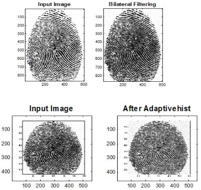 Figure.3. Images after Bilateral Filter and Apative Histogram Equalization 
