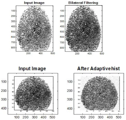 Figure.3. Images after Bilateral Filter and Apative Histogram Equalization 