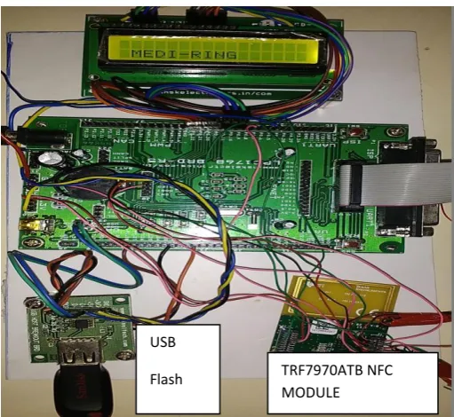 Fig-4 Final Hardware prototype.  