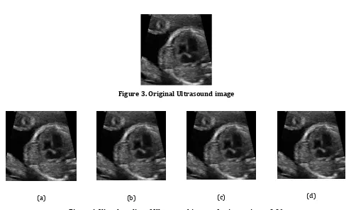 Figure 4. Visual quality of Ultrasound image of noise variance 0.01 