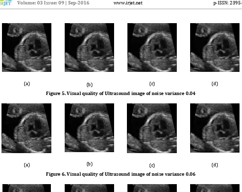 Figure 5. Visual quality of Ultrasound image of noise variance 0.04 