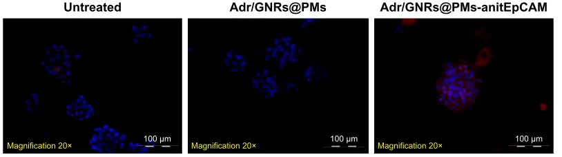 Figure 2 Identification of Adr/GNRs@PM-antiEpCAM in Hepa1-6 cell spheroids.Notes: Blue: DaPI positive staining of nuclei in the spheroid