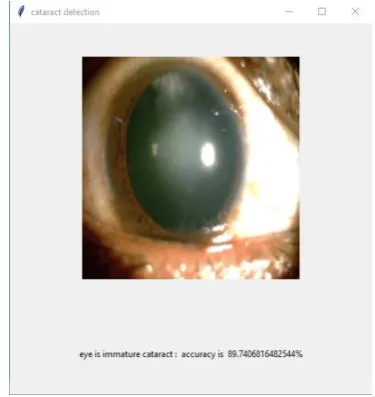 Fig. 5. Output Screen for Normal Eye 