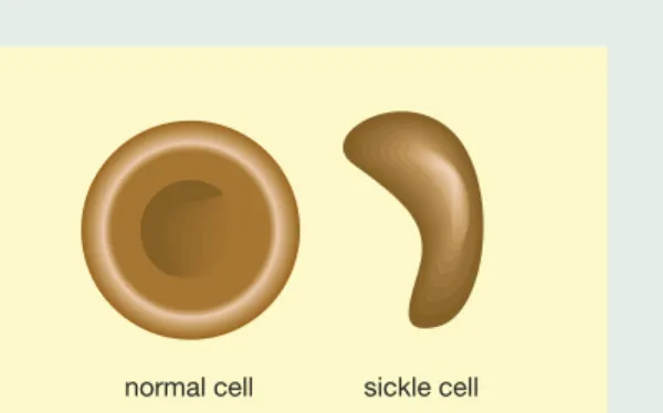 Figure D2.50: A normal cell and a sickle cell are highlighted.