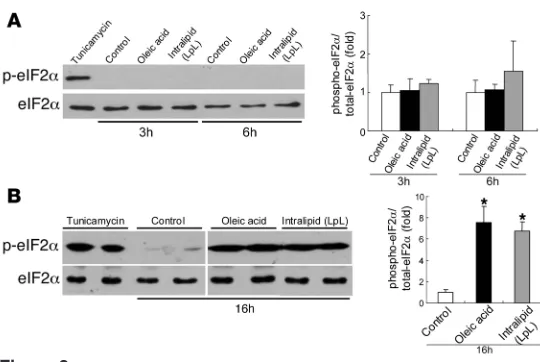 Figure 3OA or IL induces phosphorylation of eIF2α in McA cells. (A) Incubation of McA cells for 3 or 6 hours with OA (0.4 mM) or IL (500 mg/dl) did not significantly induce phosphorylation of eIF2α