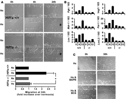 Figure 3Hif-1 enhances epithelial cell migration through induction of lysyl oxidases. (A) Hif1a+/+ or Hif1a–/– PTECs were cultured under normoxia or hypoxia for 6 days