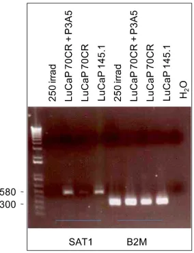 Figure 6: Differential expression of SAT1. SAT1 expression levels in the cell cultures listed on the top are represented by the PCR product band intensity