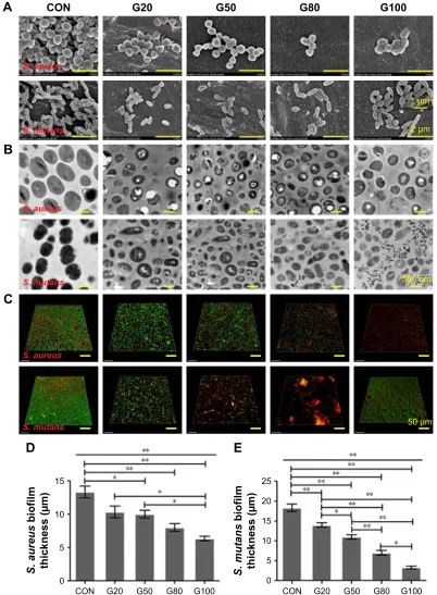 Figure 8 Morphological and structural evaluation of bacterial biofilm on specimen’s surface of Ti-GO-Ag nanocomposite.Abbreviations:Notes: (A) Typical morphology of Staphylococcus aureus and Streptococcus mutans using seM