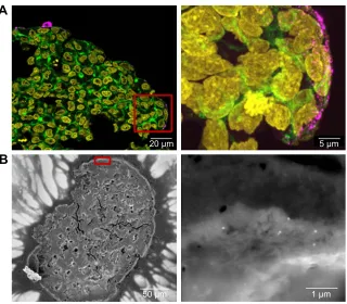 Figure 6 Distribution of siO2 NPs in hepg2 spheroids after spheroid formation.Notes: 100 µg ml−1 siO2 NPs were applied 7 days after seeding for 24 hours
