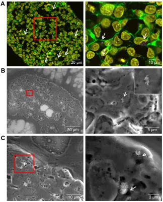 Figure 7 Distribution of siO2 NPs in hepg2 spheroids added at the beginning of spheroid formation.Notes: 100 µg ml−1 siO2 NPs were applied at seeding day 0 for 7 days