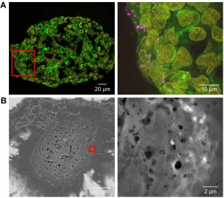 Figure 8 Distribution of siO2 NPs in hepg2 spheroids during spheroid formation.Notes: 100 µg ml−1 siO2 NPs were applied at day 2 after seeding for 5 days