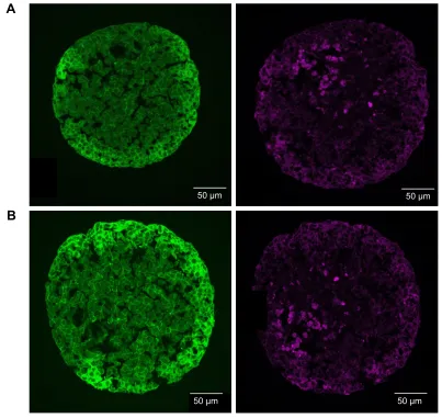 Figure S4 Nanoparticle localization in spheroids.Notes: hepg2 spheroids were exposed to 100 µg ml−1 siO2 NPs either after spheroid formation (A) or during spheroid formation at day 0 (B) or day 2 (C)