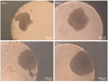 Figure 2 spheroid morphology during formation.Notes: The development of HepG2 spheroids was studied over time
