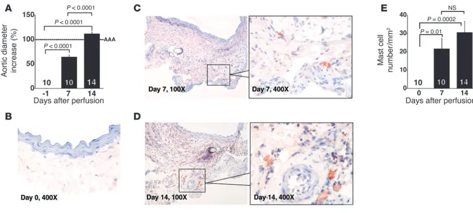 Figure 1Mast cell accumulation in elastase perfusion–induced AAA. (A) Percentage of aortic diameter increase of AAA lesions harvested from different 