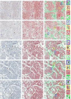 Fig. 4. Results of (a) cell detection, (b) segmentation, and (c) classification on several randomly selected image patches