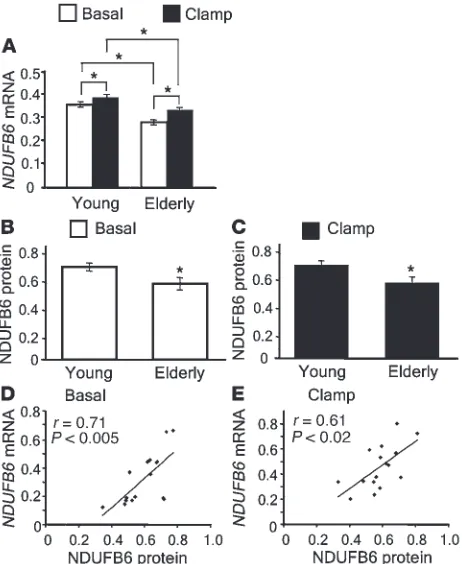 Figure 1Effects of age and insulin on human skeletal muscle NDUFB6 lev-els. (A) Skeletal muscle biopsies were taken from young (n = 91) and elderly (n = 70) twins, before and after a hyperinsulinemic clamp