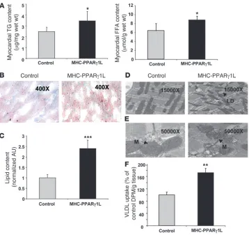 Figure 3Increased heart lipid accumulation in MHC-PPARγ1 mice. (A) Heart TG (left panel) and FFA content (right panel) was significantly increased in MHC-PPARγ1L transgenic mice (n = 7 for each group)