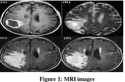 Figure 1: MRI images 