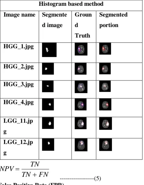 Figure: 3 MR Images From The Database  Histogram Based MR Imagessegmentationdescription 