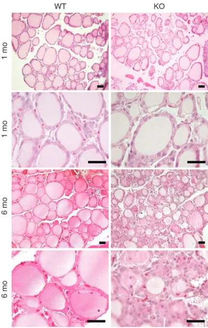 Figure 3Histological analysis of thyroids from wild-type and Tc-G
