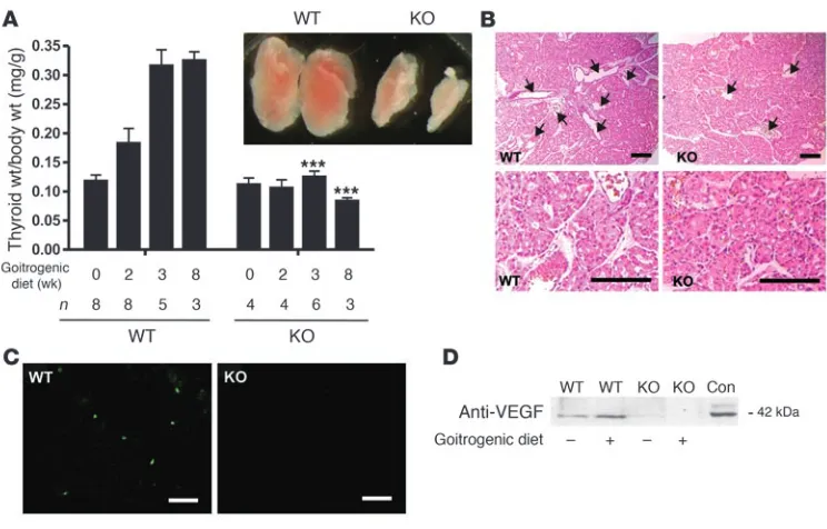 Figure 6Role of Gtrogenic diet 0–8 weeks, and thyroid weights were determined thereafter