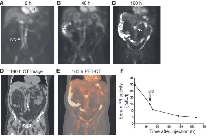 Figure 6Immuno-PET imaging of colorectal cancer in patients with between the major blood vessels