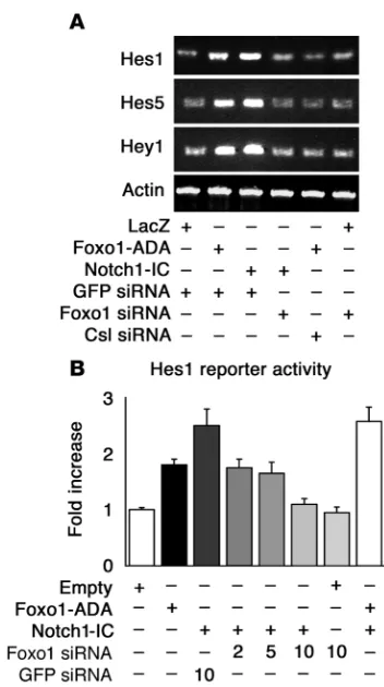 Figure 5Foxo1 regulates Notch-induced Hes1, Hes5, and Hey1 expression. 