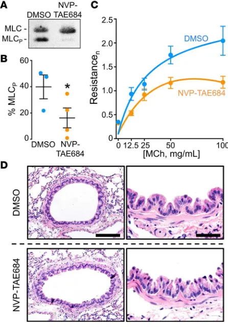 Figure 6. PYK2 inhibition decreases myosin light chain phosphorylation and cho-linergic-induced airway narrowing