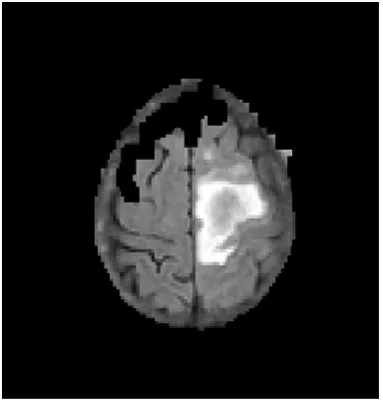 Fig. 3 Pre-processed MR Image 