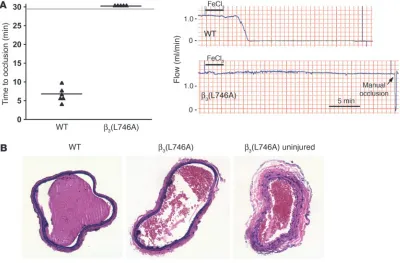 Figure 4β3(L746A) mice are protected from arterial thrombosis. (A) Thrombosis was induced in the carotid artery of mice by a 3-minute application of 5% ferric chloride to the surface of the vessel