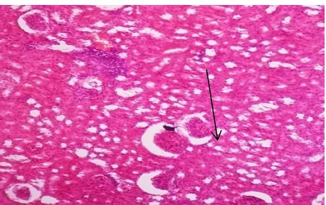 Figure 1: Histology of GT group at 10 days duration showing distorted tubular epithelium (black arrow) and cellular edema