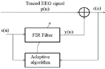 Fig. 1. Configuration of Adaptive Noise Eliminator   