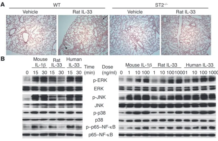 Figure 7Rat IL-33 has weaker potency than human IL-33 and causes focal pulmonary inflammation in mice