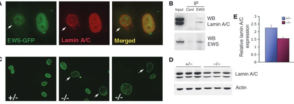 Figure 6Endogenous interaction of EWS and lamin A/C. (A) Localization of GFP-EWS and endogenous lamin A/C in PC3 cells by immunofluorescence 