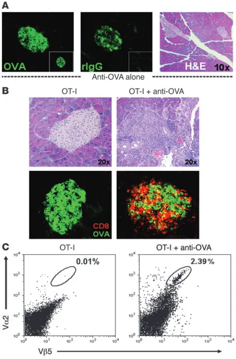 Figure 2Anti-OVA IgG drives OT-I cell infiltration into the pancreas. (A) Anti-OVA IgG binds to the islets of Langerhans without causing acute inflammation