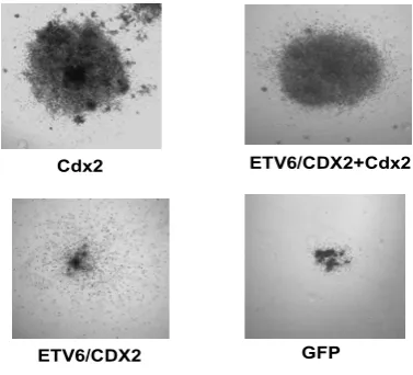 Figure 21. Colonies expressing Cdx2 or ETV6/CDX2 & Cdx2 were increased in size. Mi-croscopic picture of the colonies (50X) in the primary CFC-assay expressing Cdx2 or ETV6/CDX2 & Cdx2