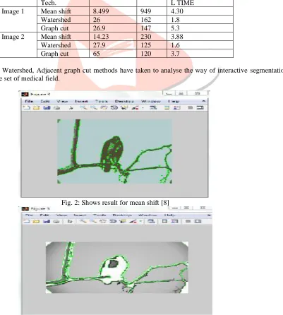 Fig. 2: Shows result for mean shift [8] 